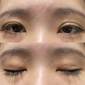 アリエル美容クリニック アリエル美容クリニック 郡山院口コミ