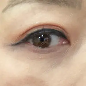 TCB東京中央美容外科 TCB東京中央美容外科 心斎橋院口コミ
