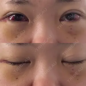 アリエル美容クリニック アリエル美容クリニック 郡山院口コミ