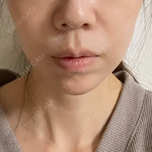 東京シンデレラ美容外科 東京シンデレラ美容外科 池袋院口コミ