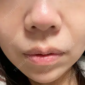 東京シンデレラ美容外科 東京シンデレラ美容外科 池袋院口コミ