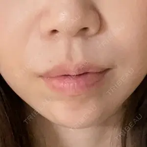 東京シンデレラ美容外科 東京シンデレラ美容外科 池袋院口コミ