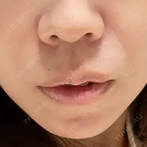 東京シンデレラ美容外科 東京シンデレラ美容外科 池袋院口コミ