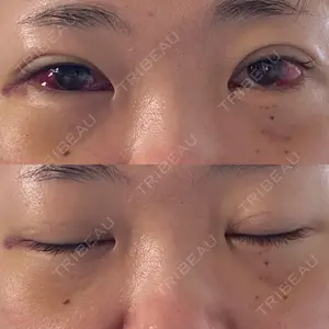 アリエル美容クリニック アリエル美容クリニック 郡山院口コミ