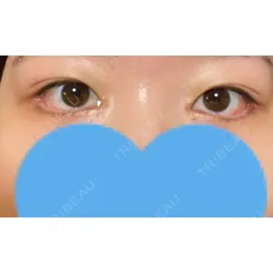 湘南美容クリニック 湘南美容クリニック 表参道院口コミ