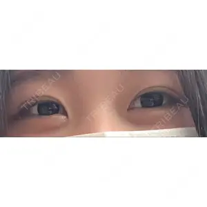 T CLINIC 新宿院口コミ
