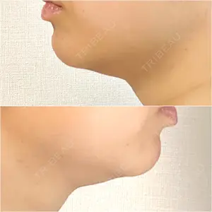 口コミ