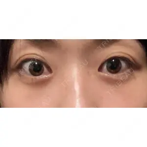 APOLLO BEAUTY CLINIC口コミ