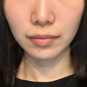 湘南美容クリニック 湘南美容クリニック 新宿本院口コミ