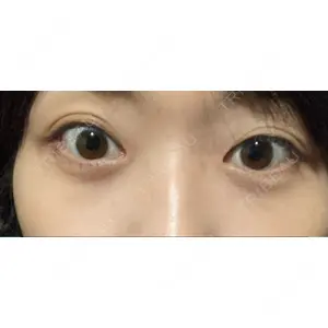 APOLLO BEAUTY CLINIC口コミ