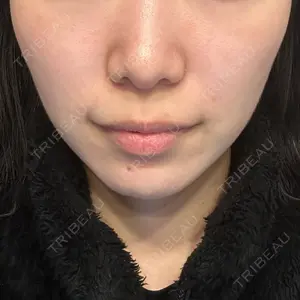 湘南美容クリニック 湘南美容クリニック 新宿本院口コミ