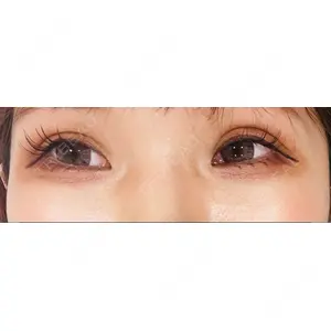 HAAB×DREAM BEAUTY CLINIC HAAB×DREAM BEAUTY CLINIC 東京本院口コミ
