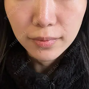 湘南美容クリニック 湘南美容クリニック 新宿本院口コミ