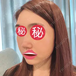 口コミ