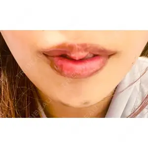 BELINDA CLINIC BELINDA CLINIC（ベリンダクリニック）新宿院口コミ