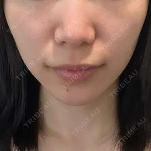 湘南美容クリニック 湘南美容クリニック 新宿本院口コミ