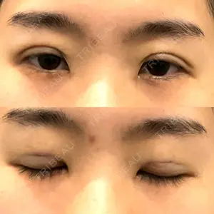 アリエル美容クリニック アリエル美容クリニック 郡山院口コミ