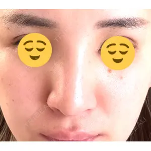 口コミ