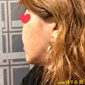 X CLINIC X CLINIC 銀座院口コミ