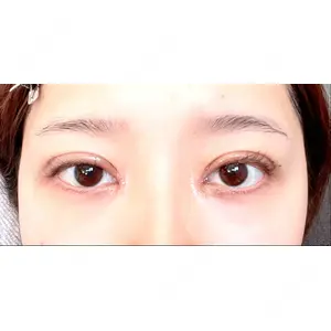 口コミ