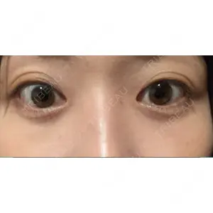 APOLLO BEAUTY CLINIC口コミ