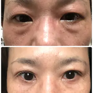 JBCジュノビューティークリニック 新宿三丁目院口コミ