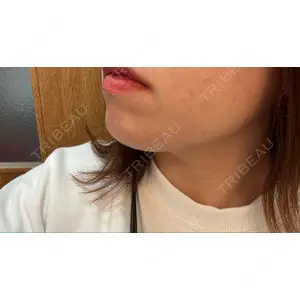 口コミ