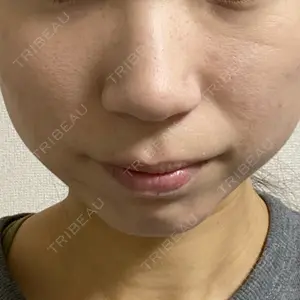 まゆりなclinic 名古屋栄口コミ