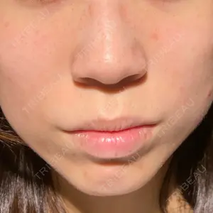まゆりなclinic 名古屋栄口コミ