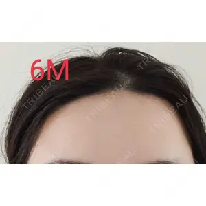 SH整形外科口コミ