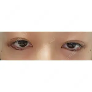 B-LINE CLINIC B-LINE CLINIC 池袋院口コミ