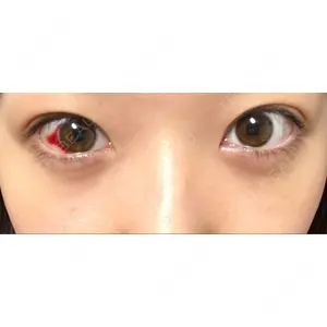 APOLLO BEAUTY CLINIC口コミ