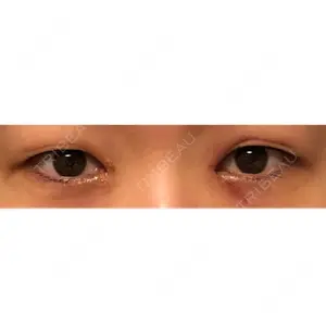 湘南美容クリニック 渋谷院の