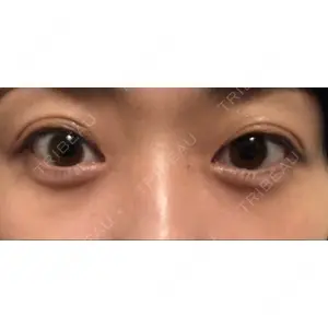APOLLO BEAUTY CLINIC口コミ