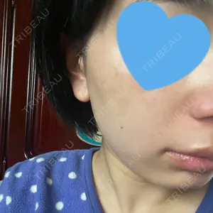 Rosa Beauty Clinic口コミ