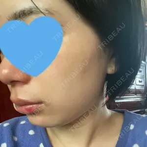 Rosa Beauty Clinic口コミ