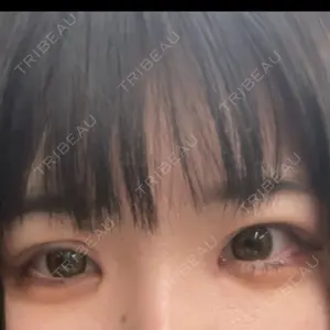 アネシス美容クリニック口コミ