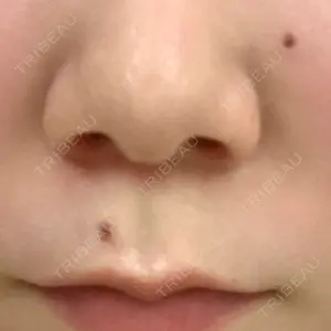 Re:anne clinic 銀座 【リアンクリニック銀座】口コミ