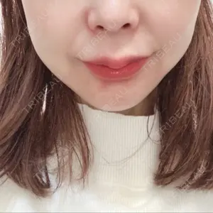 共立美容外科・歯科 共立美容外科 梅田院口コミ