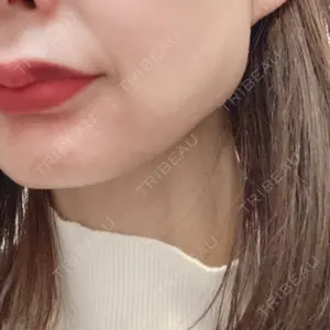 共立美容外科・歯科 共立美容外科 梅田院口コミ