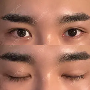 TCB東京中央美容外科 TCB東京中央美容外科 新宿三丁目院口コミ