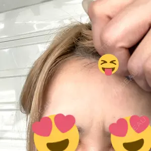 TCB東京中央美容外科 TCB東京中央美容外科 千葉駅前院口コミ