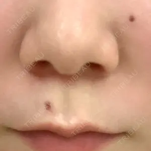 Re:anne clinic 銀座 【リアンクリニック銀座】口コミ