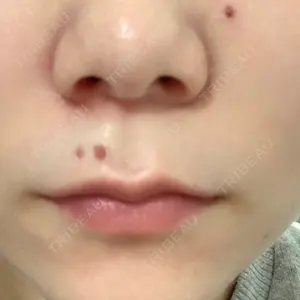 Re:anne clinic 銀座 【リアンクリニック銀座】口コミ