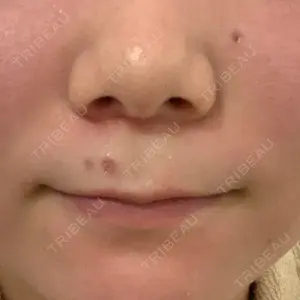 Re:anne clinic 銀座 【リアンクリニック銀座】口コミ