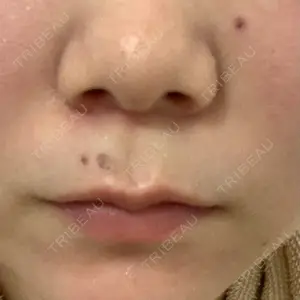 Re:anne clinic 銀座 【リアンクリニック銀座】口コミ