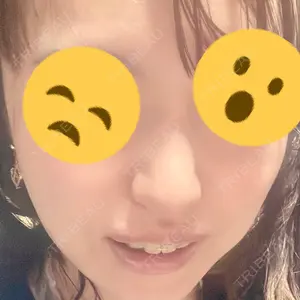 グローバルビューティークリニック 東京院の