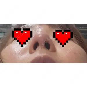 T CLINIC 新宿院口コミ