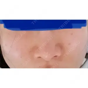 まゆりなclinic 名古屋栄口コミ