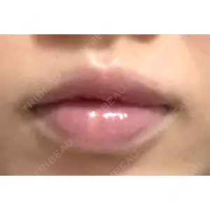 B-LINE CLINIC B-LINE CLINIC 池袋院口コミ